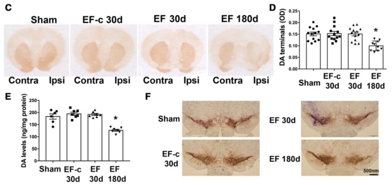 brain:小胶质细胞外泌体可引起帕金森病病变