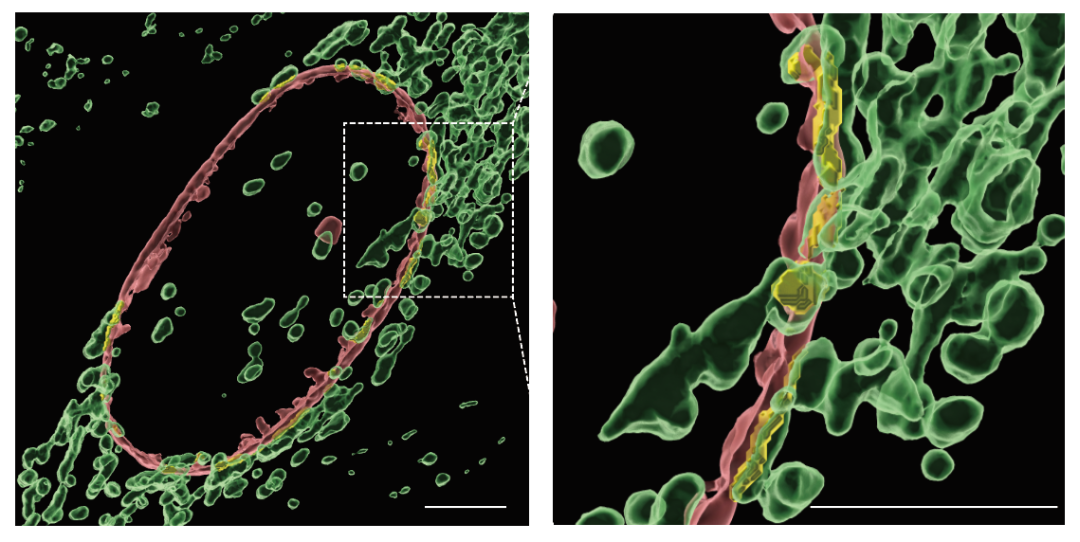 新揭示长寿蛋白sirt3延缓衰老的表观遗传机制