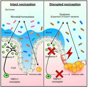 Cell:发现痛觉神经元对炎症性肠病保护作用机制_美必思医学编译